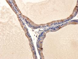 Immunohistochemical staining of paraffin embedded rat prostate tissue using anti-IL11 (5 ug/ml)
