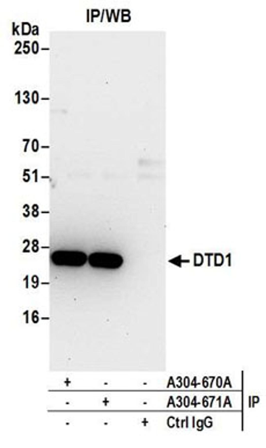 Detection of human DTD1 by western blot of immunoprecipitates.