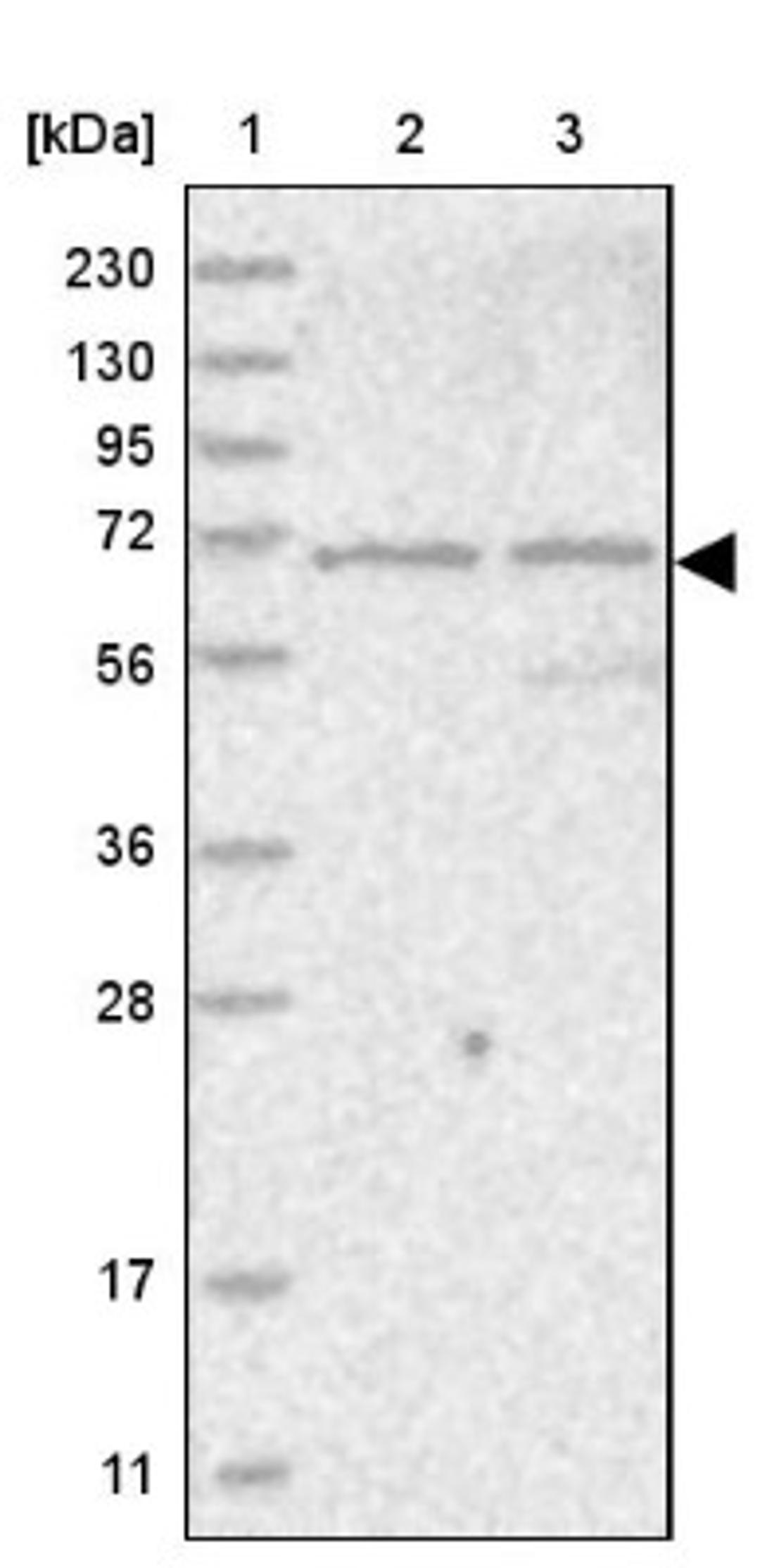 Western Blot: LOXL3 Antibody [NBP1-85908] - Lane 1: Marker [kDa] 230, 130, 95, 72, 56, 36, 28, 17, 11<br/>Lane 2: Human cell line RT-4<br/>Lane 3: Human cell line U-251MG sp