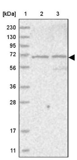 Western Blot: LOXL3 Antibody [NBP1-85908] - Lane 1: Marker [kDa] 230, 130, 95, 72, 56, 36, 28, 17, 11<br/>Lane 2: Human cell line RT-4<br/>Lane 3: Human cell line U-251MG sp