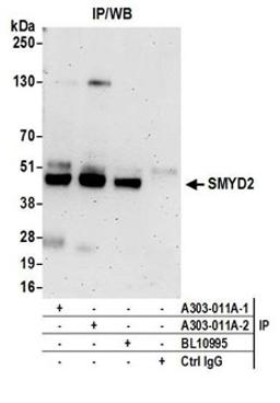 Detection of human SMYD2 by western blot of immunoprecipitates.