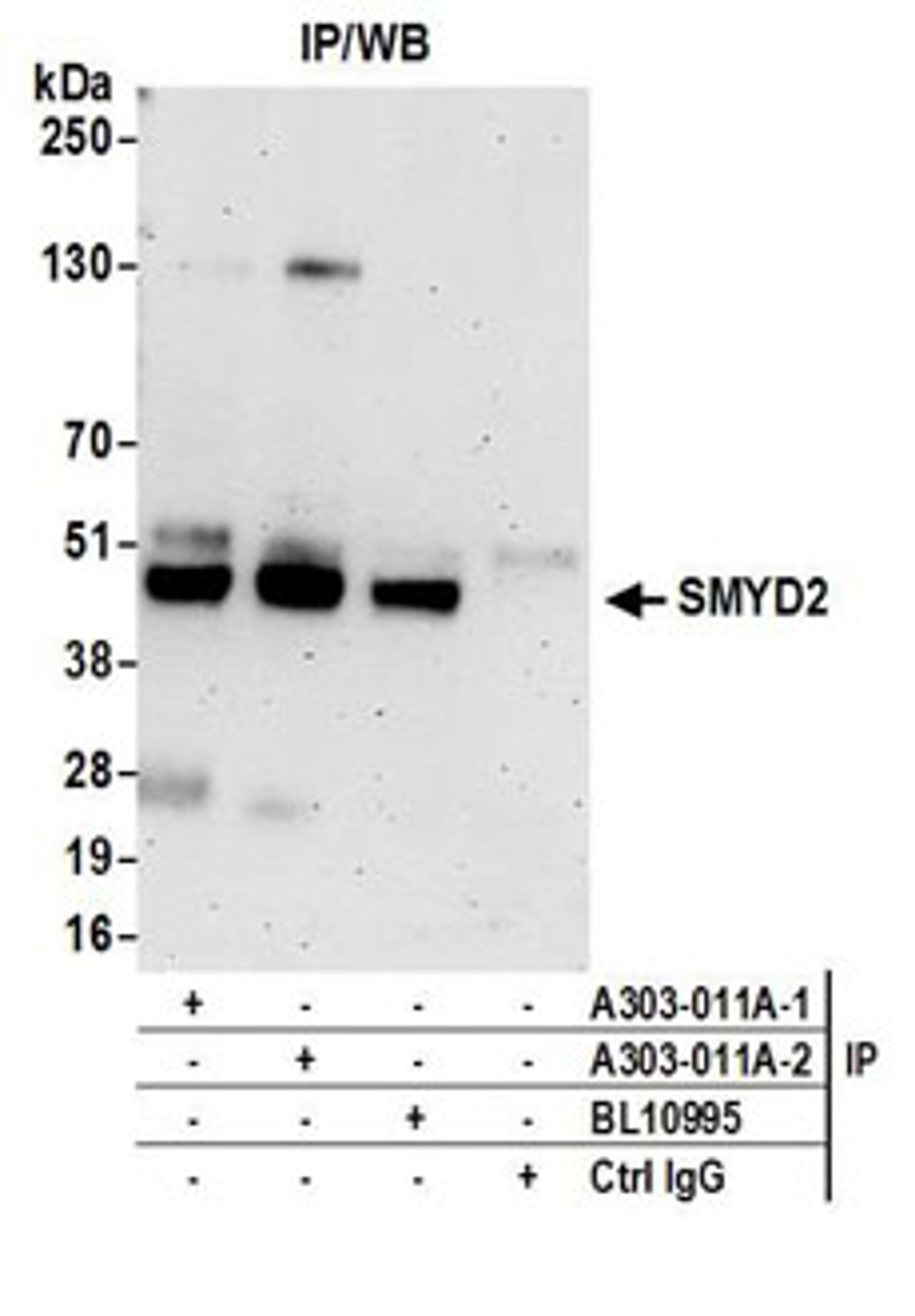 Detection of human SMYD2 by western blot of immunoprecipitates.