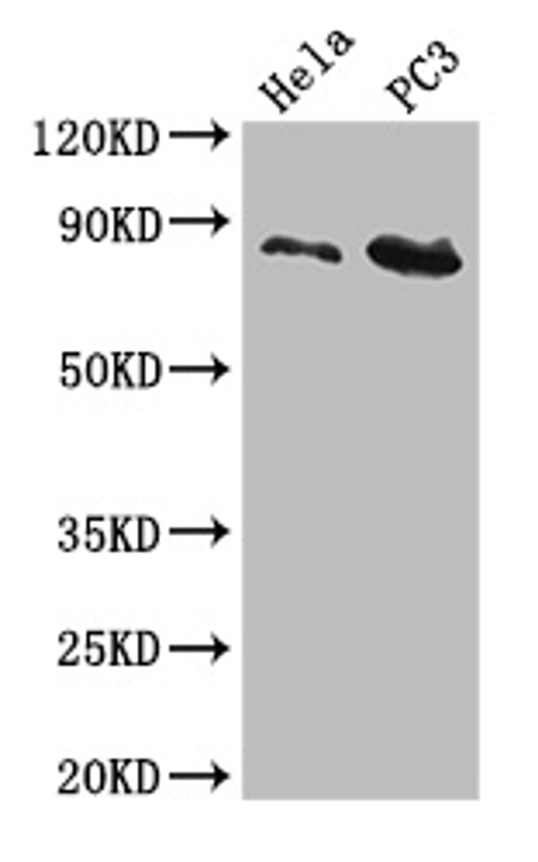 Western Blot. Positive WB detected in: Hela whole cell lysate, PC-3 whole cell lysate. All lanes: CUL2 antibody at 5µg/ml. Secondary. Goat polyclonal to rabbit IgG at 1/50000 dilution. Predicted band size: 87, 90 kDa. Observed band size: 87 kDa