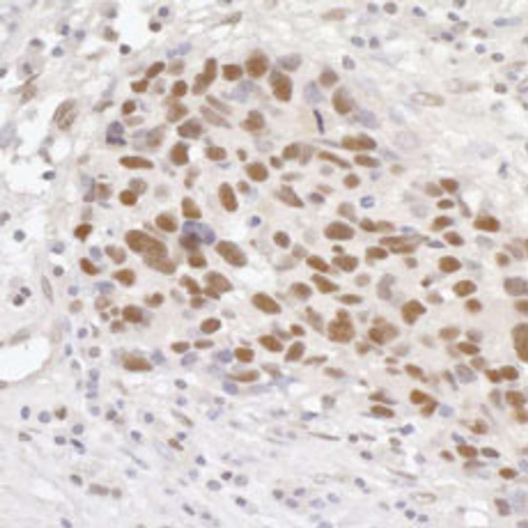 Detection of human GTF3C5/TFIIIC63 by immunohistochemistry.