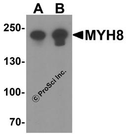 Western blot analysis of MYH8 in HeLa cell lysate with MYH8 antibody at (A) 0.5 and (B) 1 μg/ml.