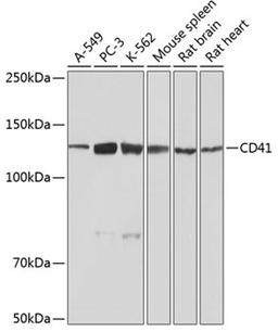 Western blot - CD41 Rabbit mAb (A11490)