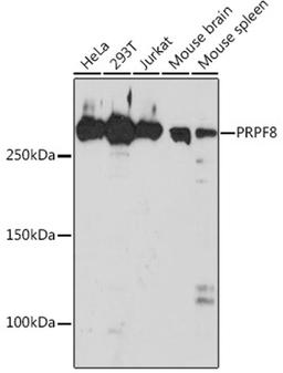 Western blot - PRPF8 Rabbit mAb (A4575)