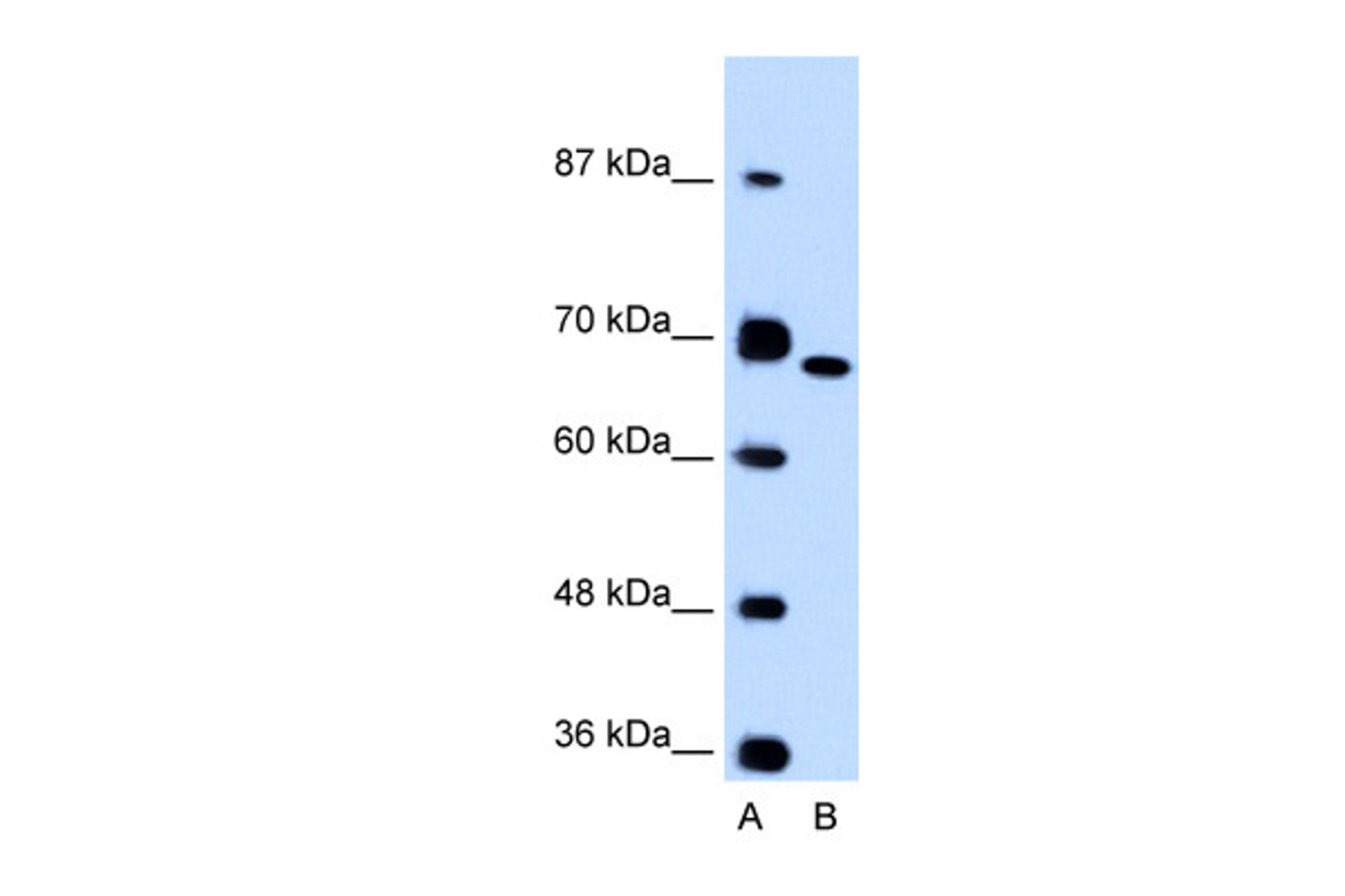 Antibody used in WB on Human Jurkat 0.2-1 ug/ml.