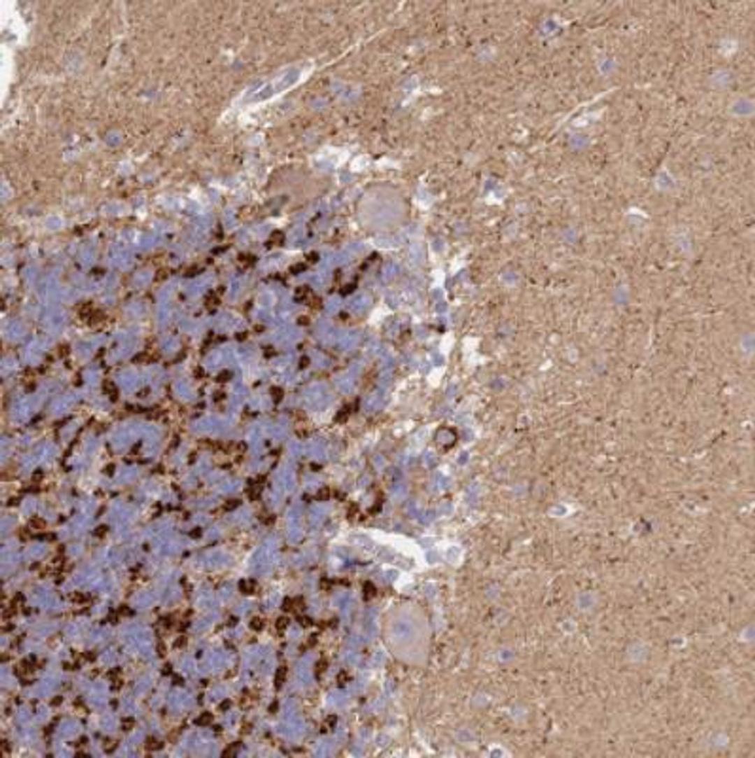 Immunohistochemistry: Synaptogyrin 3 Antibody [NBP2-30475] - Immunohistochemical staining of human cerebellum shows strong positivity in neuropil in the granular layer.