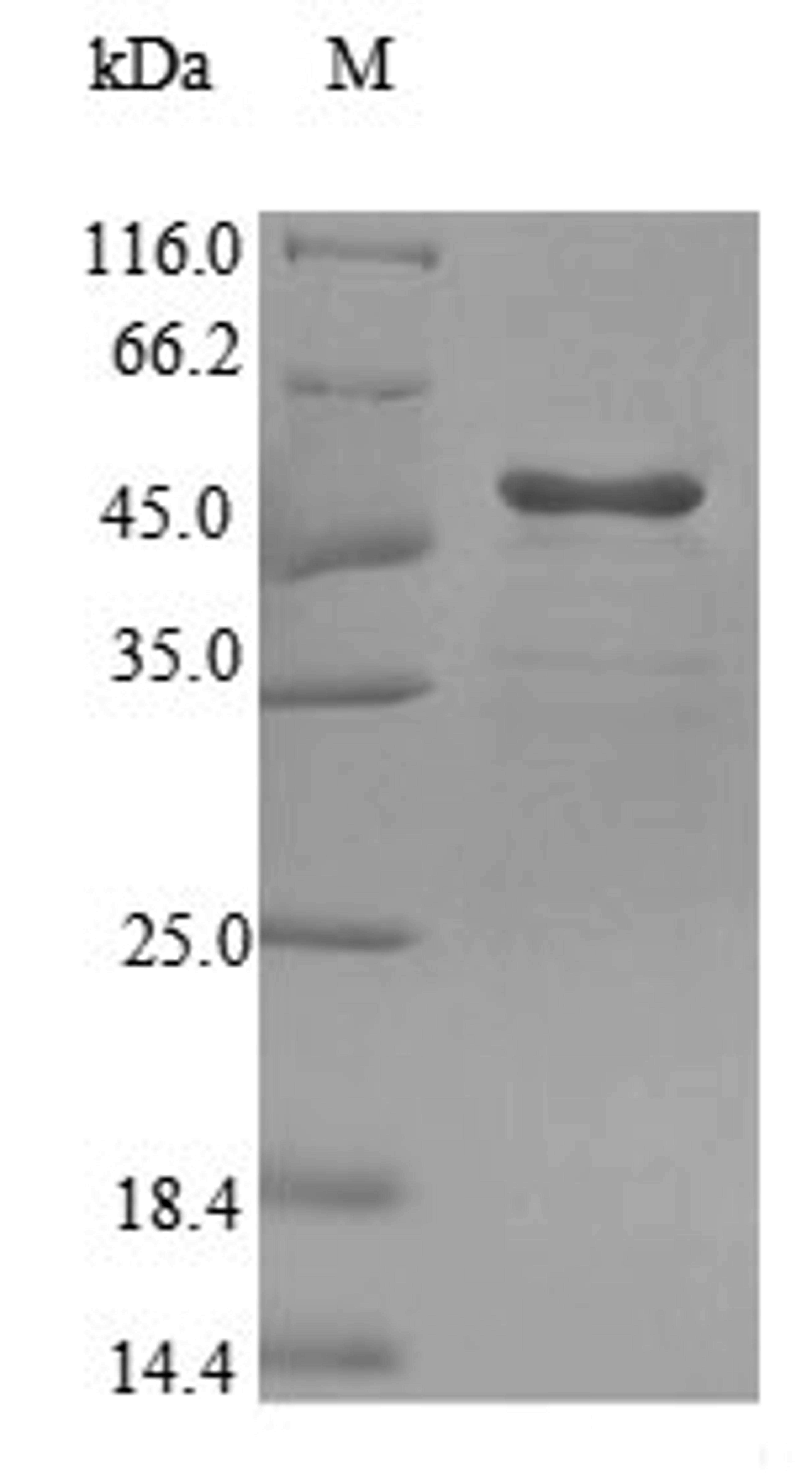(Tris-Glycine gel) Discontinuous SDS-PAGE (reduced) with 5% enrichment gel and 15% separation gel.