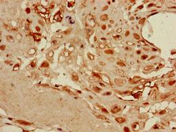 Immunohistochemistry of paraffin-embedded human placenta tissue using CSB-PA06219A0Rb at dilution of 1:100