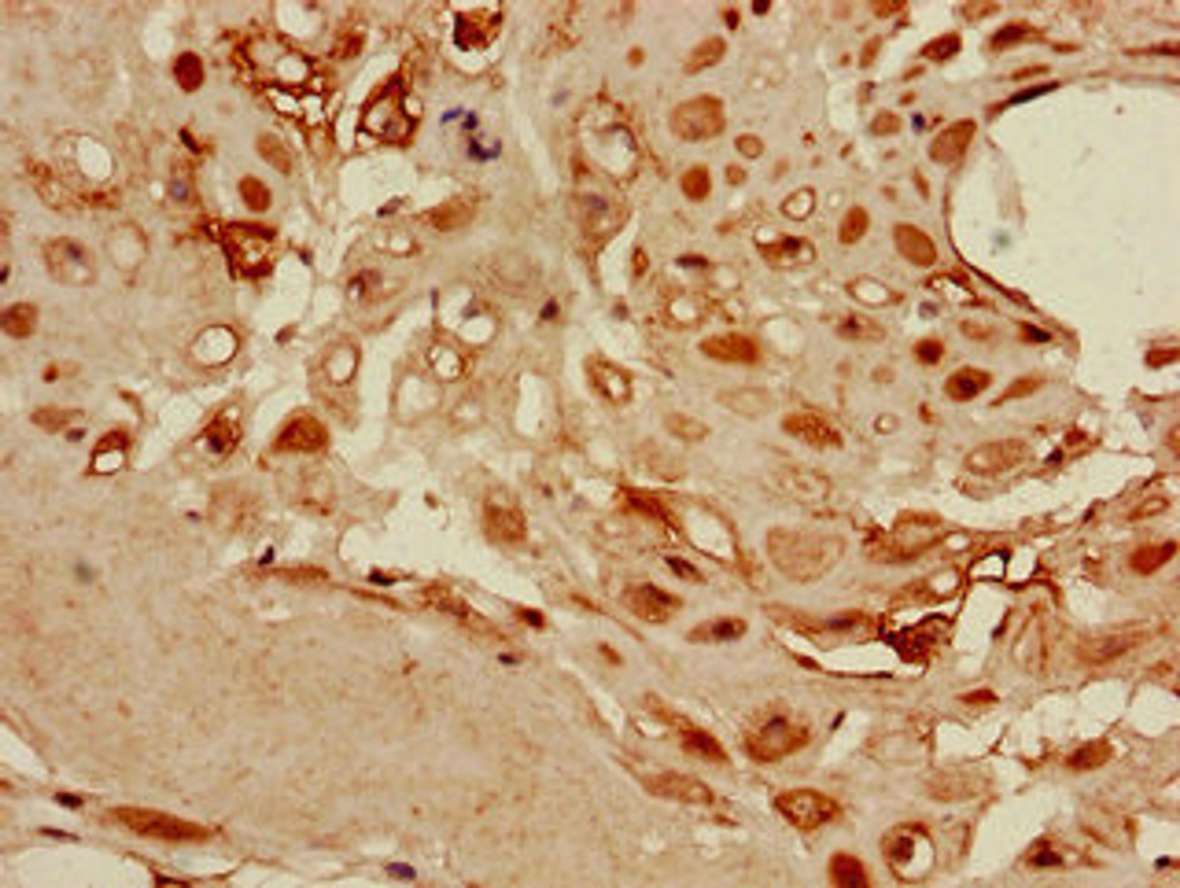 Immunohistochemistry of paraffin-embedded human placenta tissue using CSB-PA06219A0Rb at dilution of 1:100
