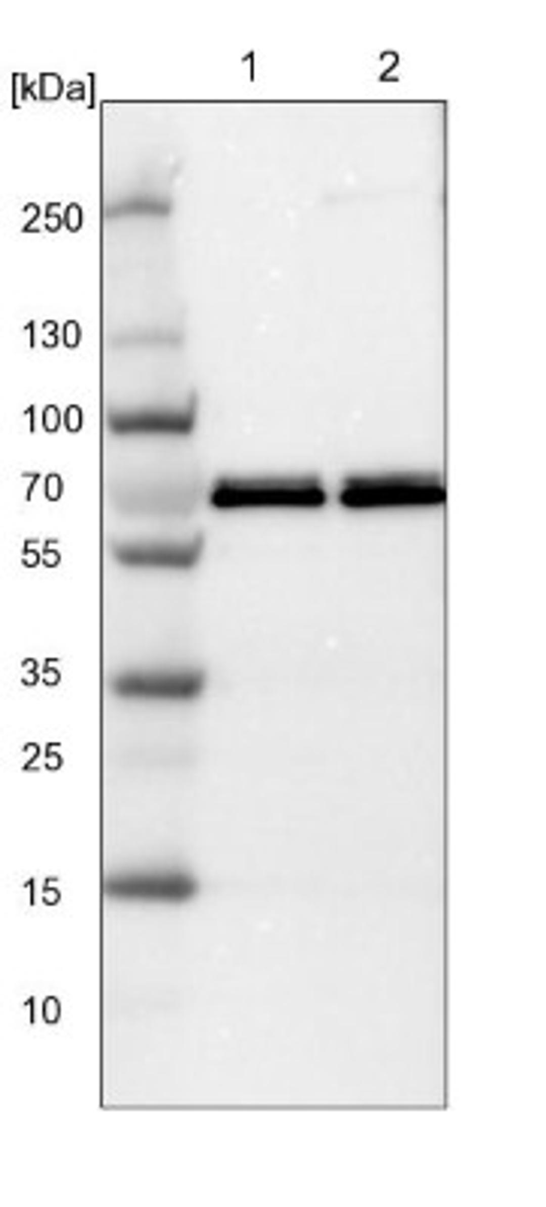 Western Blot: G3BP2 Antibody [NBP1-82977] - Lane 1: NIH-3T3 cell lysate (Mouse embryonic fibroblast cells)<br/>Lane 2: NBT-II cell lysate (Rat Wistar bladder tumour cells)