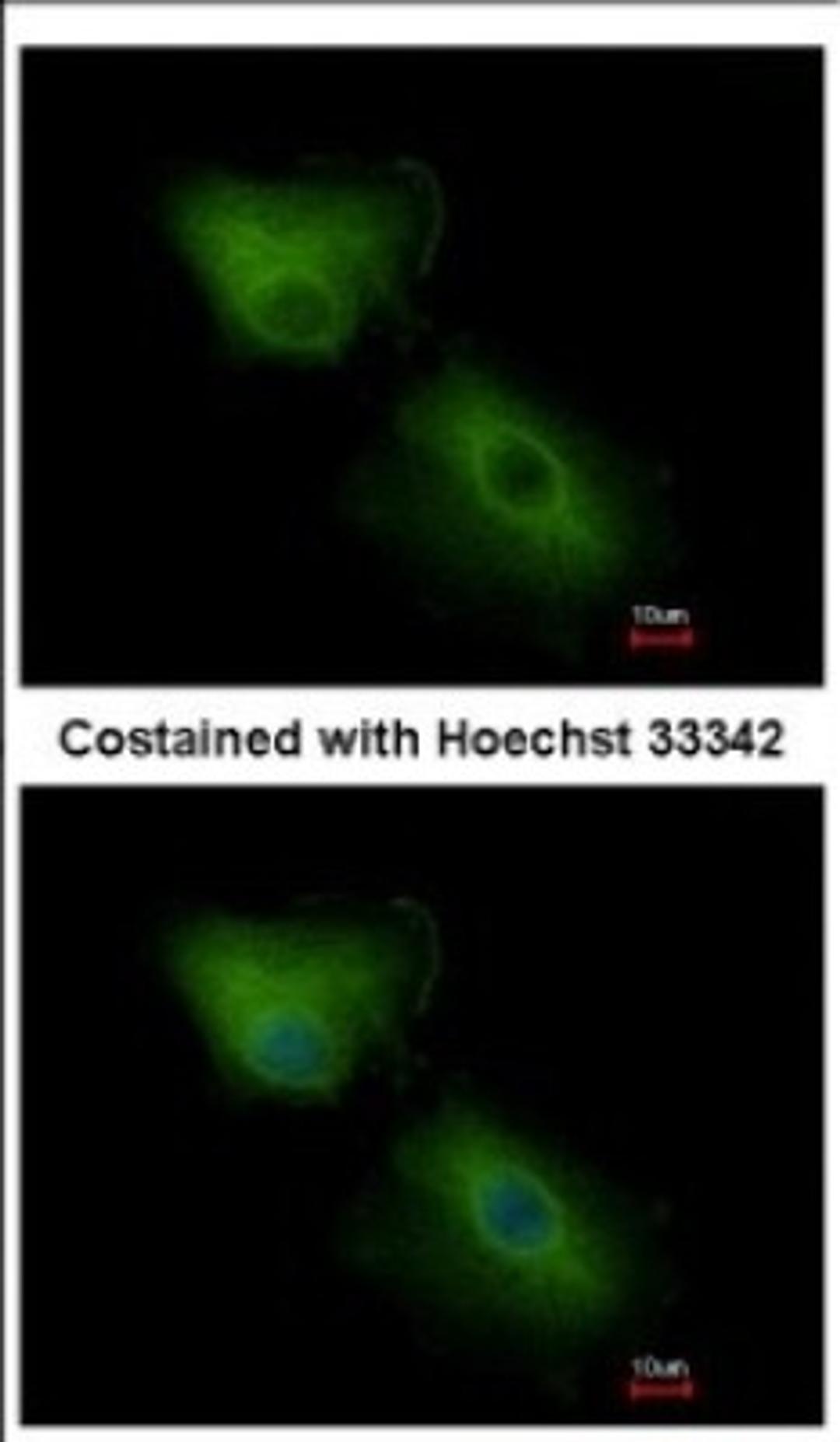 Immunocytochemistry/Immunofluorescence: CXCL16 Antibody [NBP2-16042] - Immunofluorescence analysis of methanol-fixed A549, using antibody at 1:500 dilution.