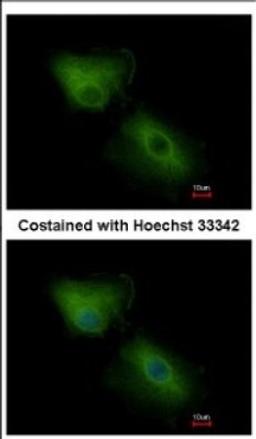 Immunocytochemistry/Immunofluorescence: CXCL16 Antibody [NBP2-16042] - Immunofluorescence analysis of methanol-fixed A549, using antibody at 1:500 dilution.