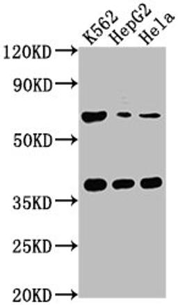 Western Blot. Positive WB detected in: K562 whole cell lysate, HepG2 whole cell lysate, Hela whole cell lysate. All lanes: CFHR5 antibody at 1:1000. Secondary. Goat polyclonal to rabbit IgG at 1/50000 dilution. Predicted band size: 65 kDa. Observed band size: 65 kDa.
