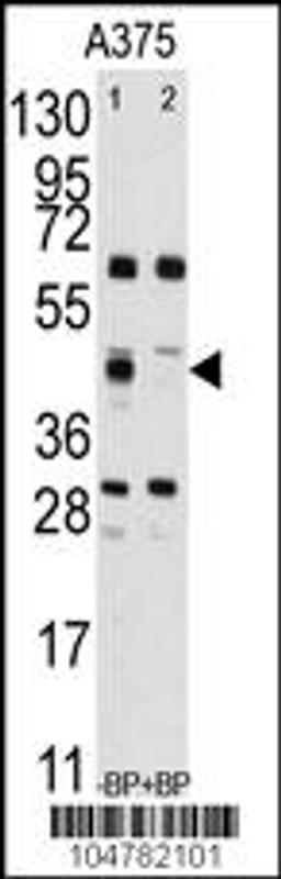 Western blot analysis of anti-FDFT1 Antibody pre-incubated without(lane 1) and with(lane 2) blocking peptide (BP2417b) in A375 cell line lysate.