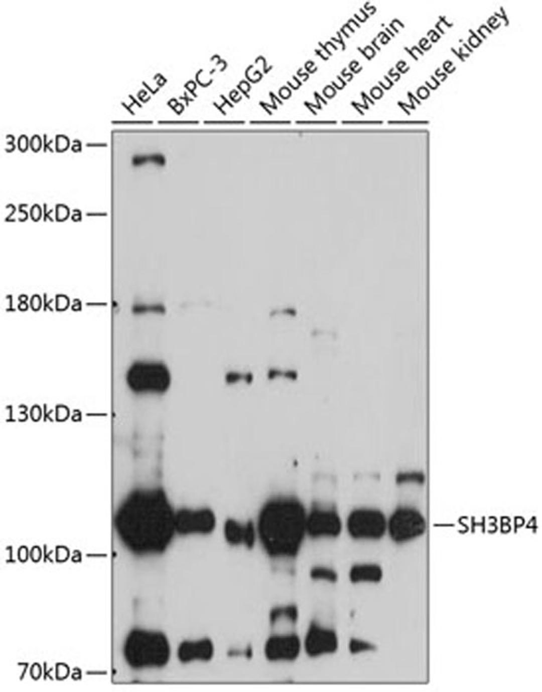 Western blot - SH3BP4 antibody (A14351)