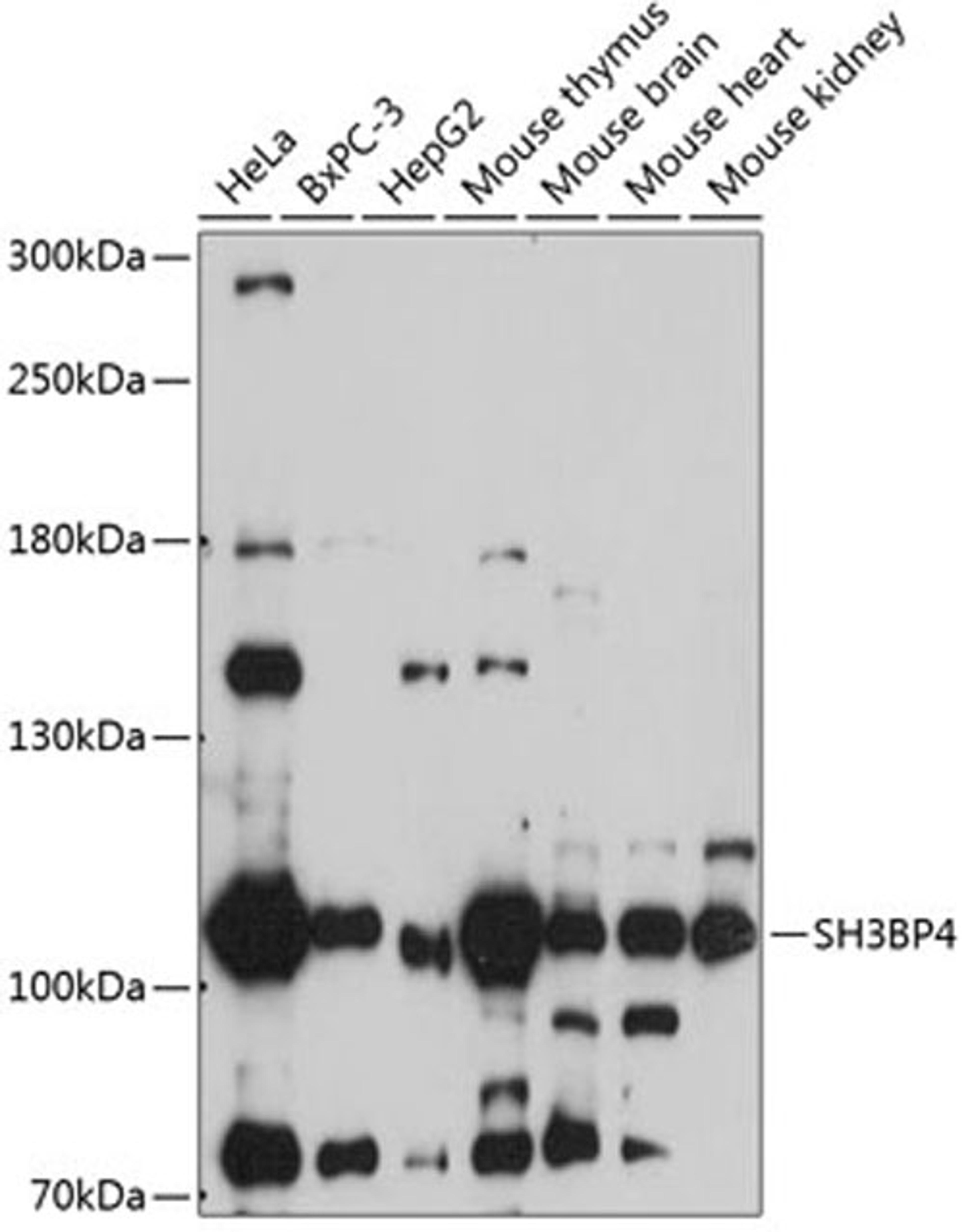 Western blot - SH3BP4 antibody (A14351)