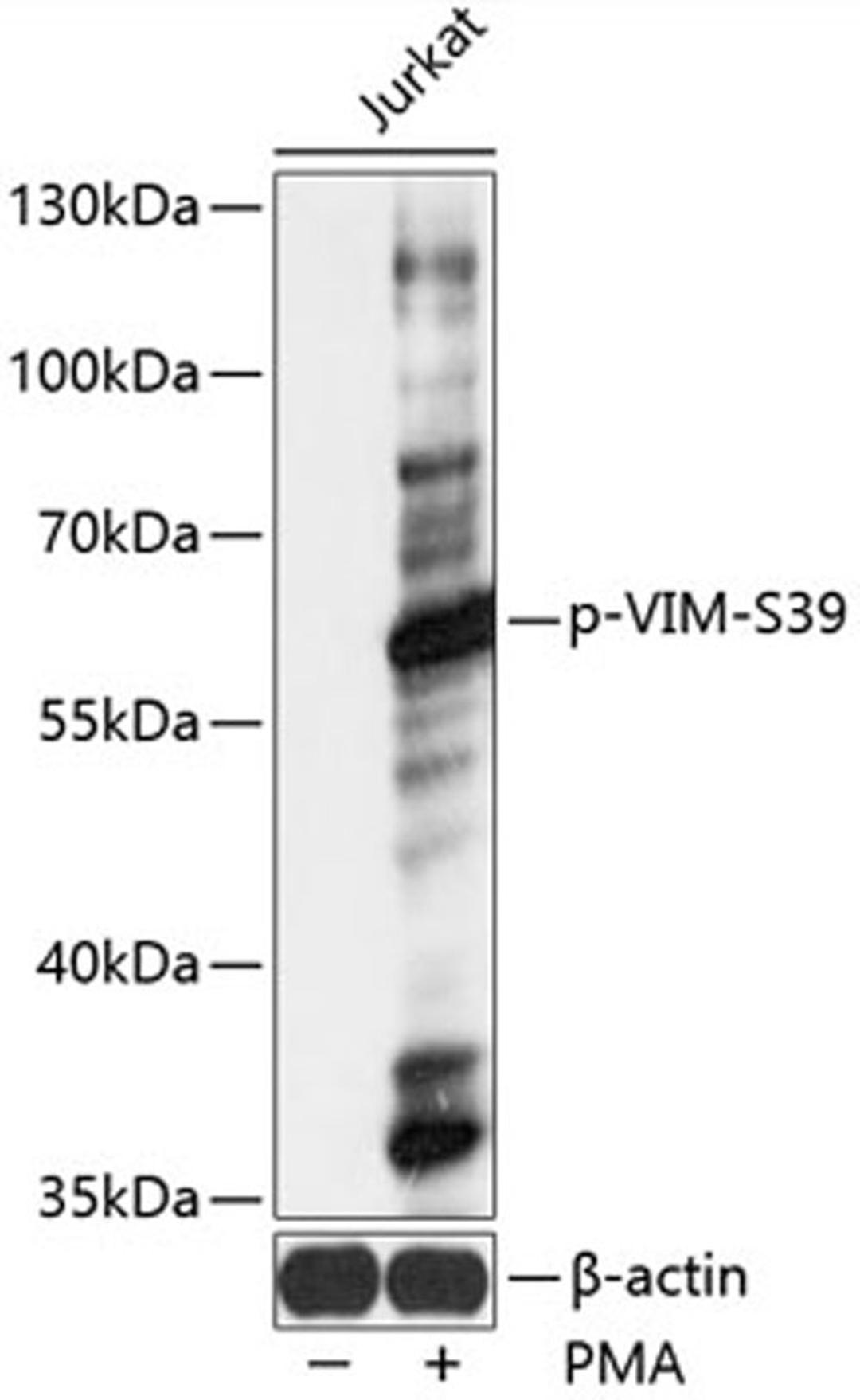 Western blot - Phospho-VIM-S39 antibody (AP0806)