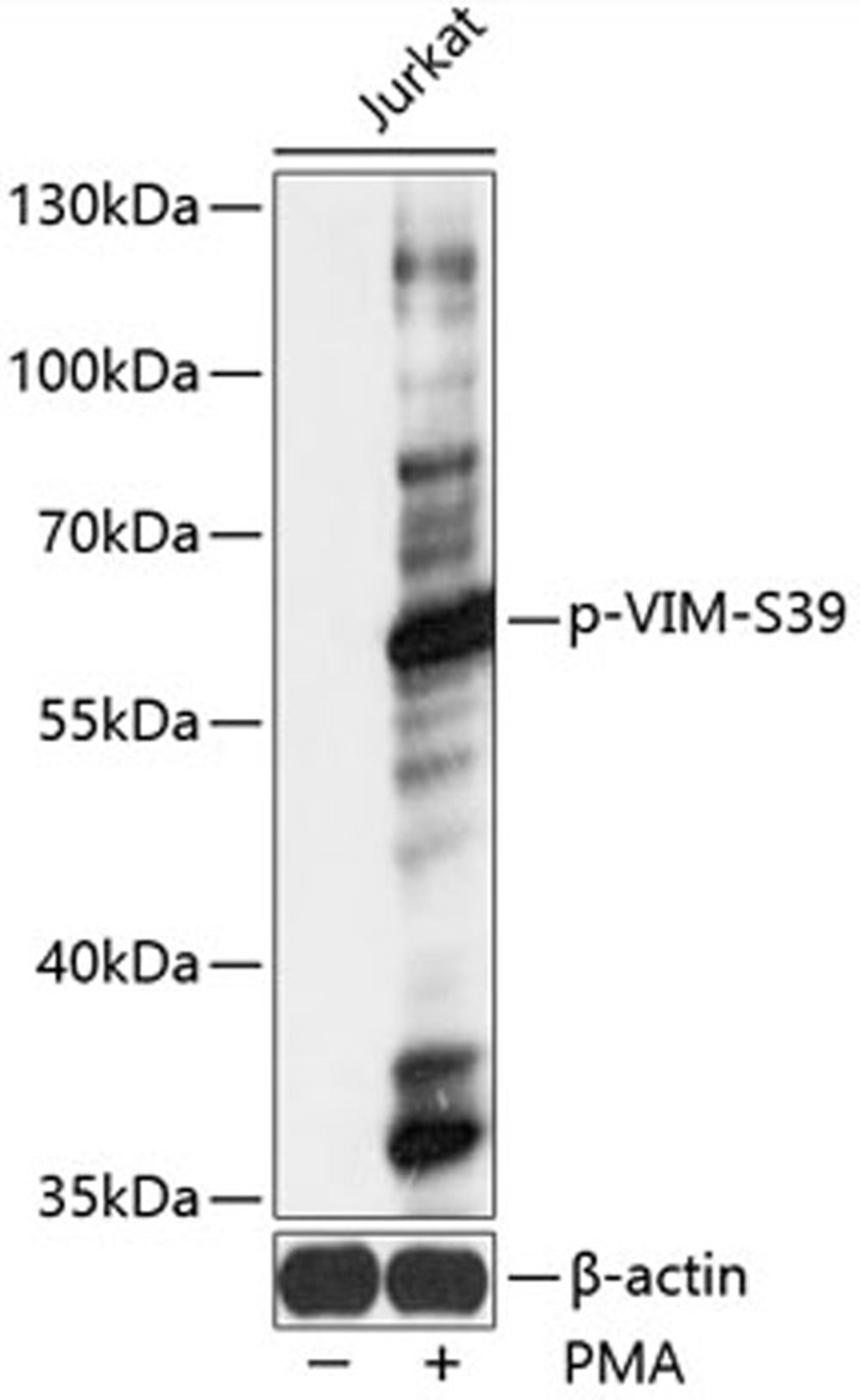 Western blot - Phospho-VIM-S39 antibody (AP0806)