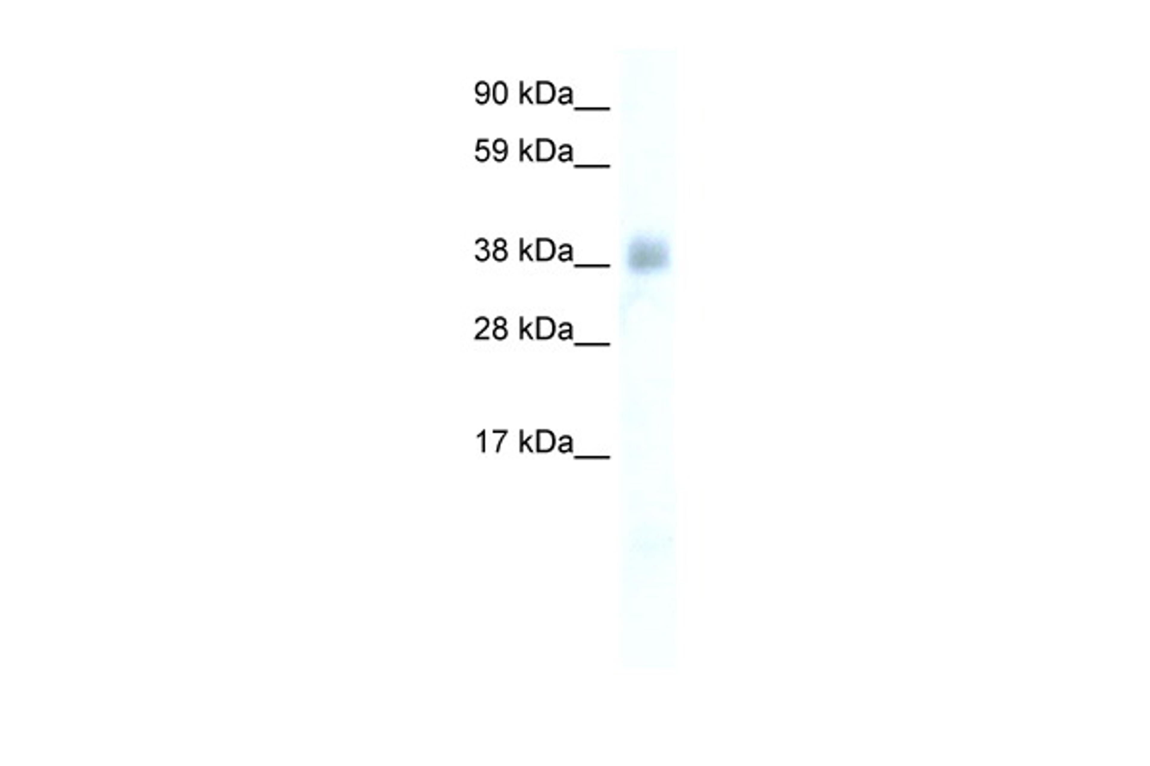 Antibody used in WB on Human Thymus at 0.2-1 ug/ml.