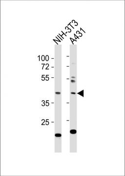 Western Blot at 1:1000 dilution Lane 1: NIH-3T3 whole cell lysates Lane 2: A431 whole cell lysates Lysates/proteins at 20 ug per lane.