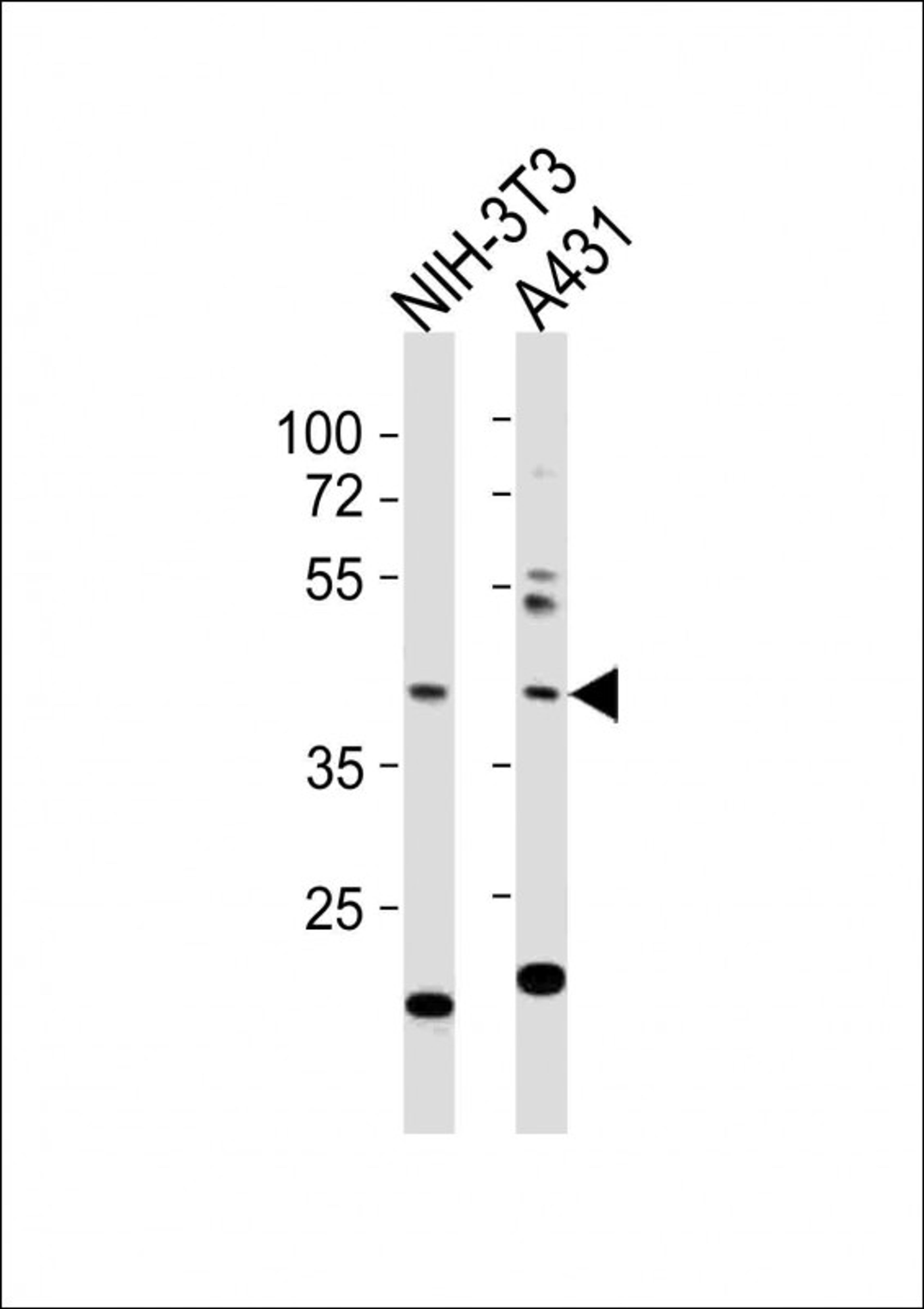 Western Blot at 1:1000 dilution Lane 1: NIH-3T3 whole cell lysates Lane 2: A431 whole cell lysates Lysates/proteins at 20 ug per lane.