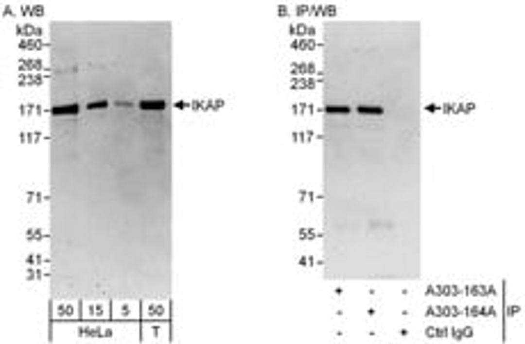 Detection of human IKAP by western blot and immunoprecipitation.