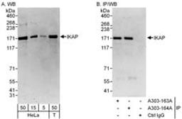 Detection of human IKAP by western blot and immunoprecipitation.