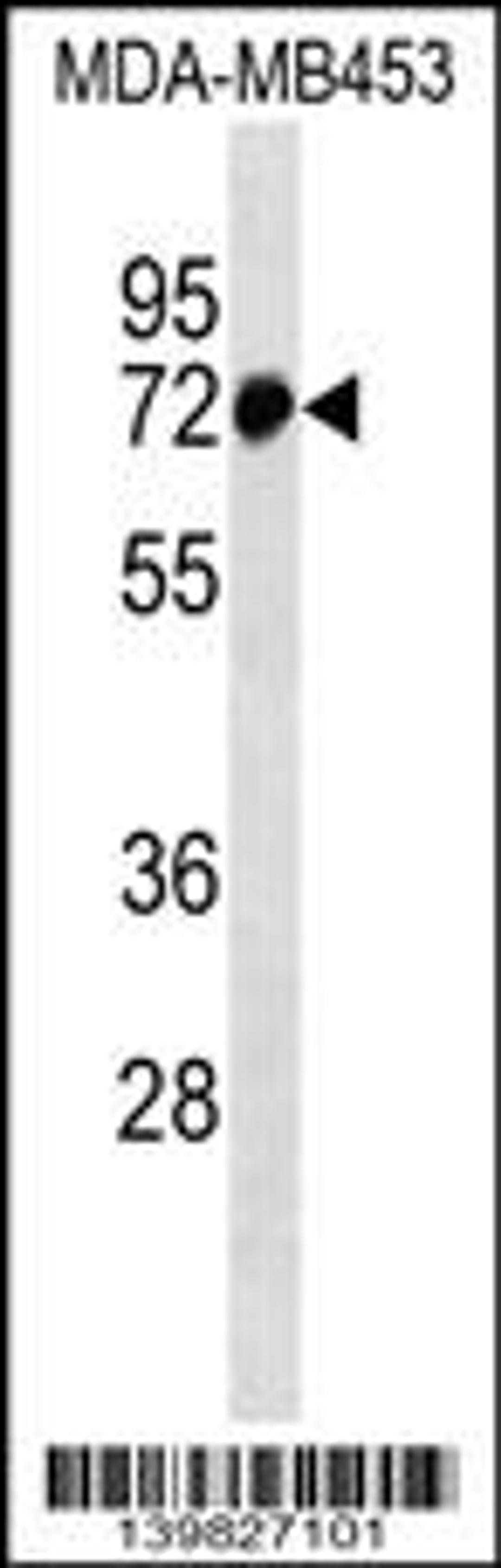 Western blot analysis in MDA-MB453 cell line lysates (35ug/lane).