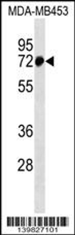 Western blot analysis in MDA-MB453 cell line lysates (35ug/lane).