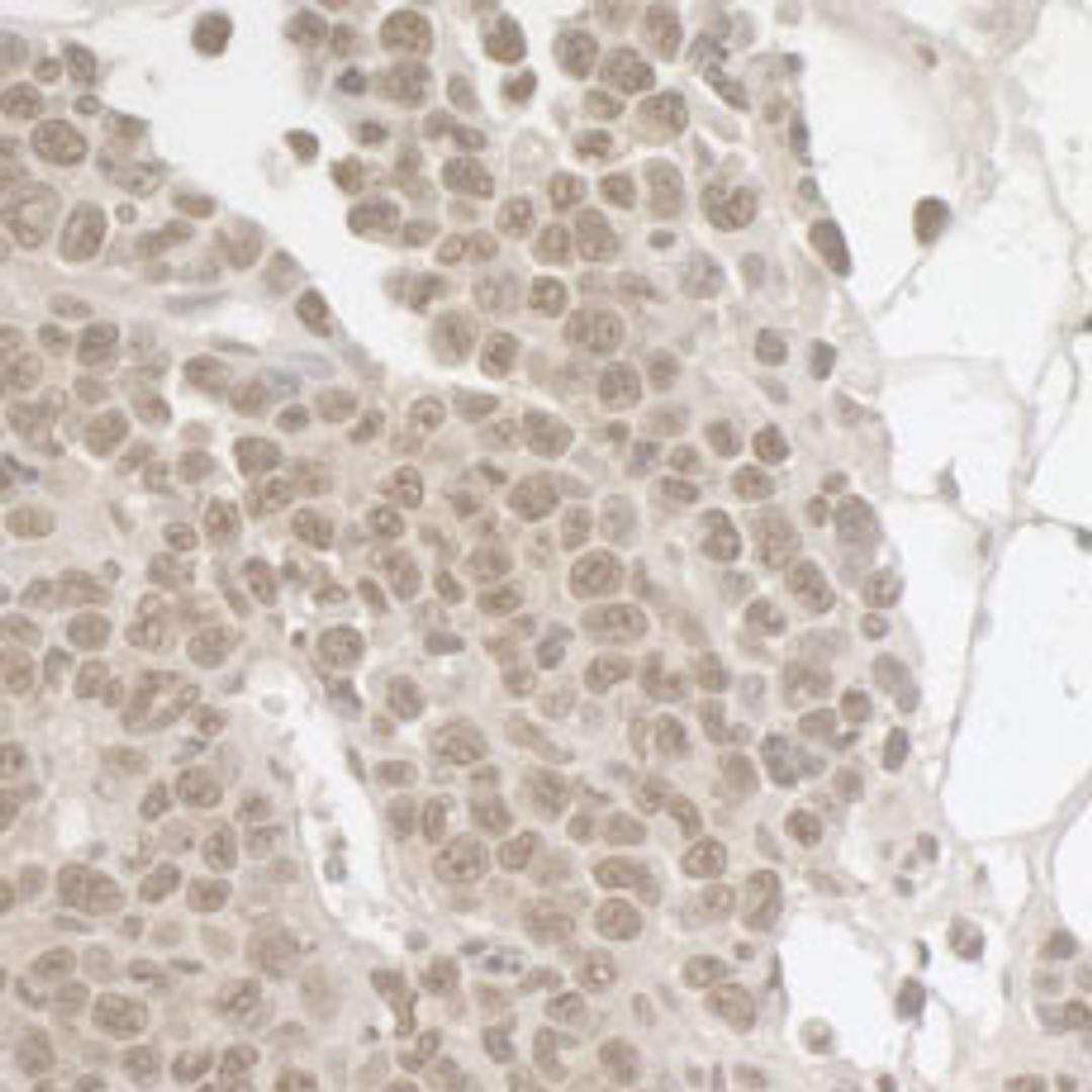 Detection of mouse SPF45 by immunohistochemistry.