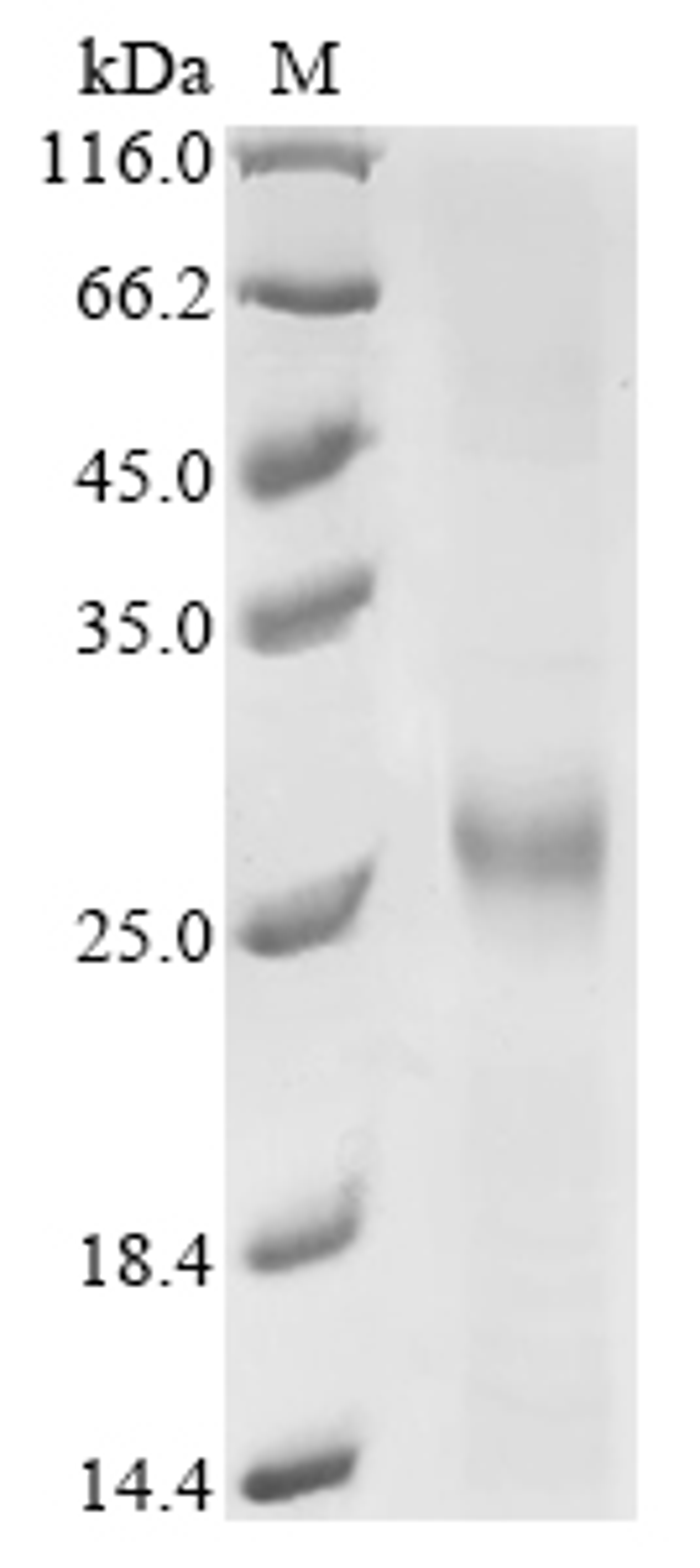 (Tris-Glycine gel) Discontinuous SDS-PAGE (reduced) with 5% enrichment gel and 15% separation gel.