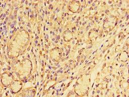Immunohistochemistry of paraffin-embedded human gastric tissue using CSB-PA021869LA01HU at dilution of 1:100