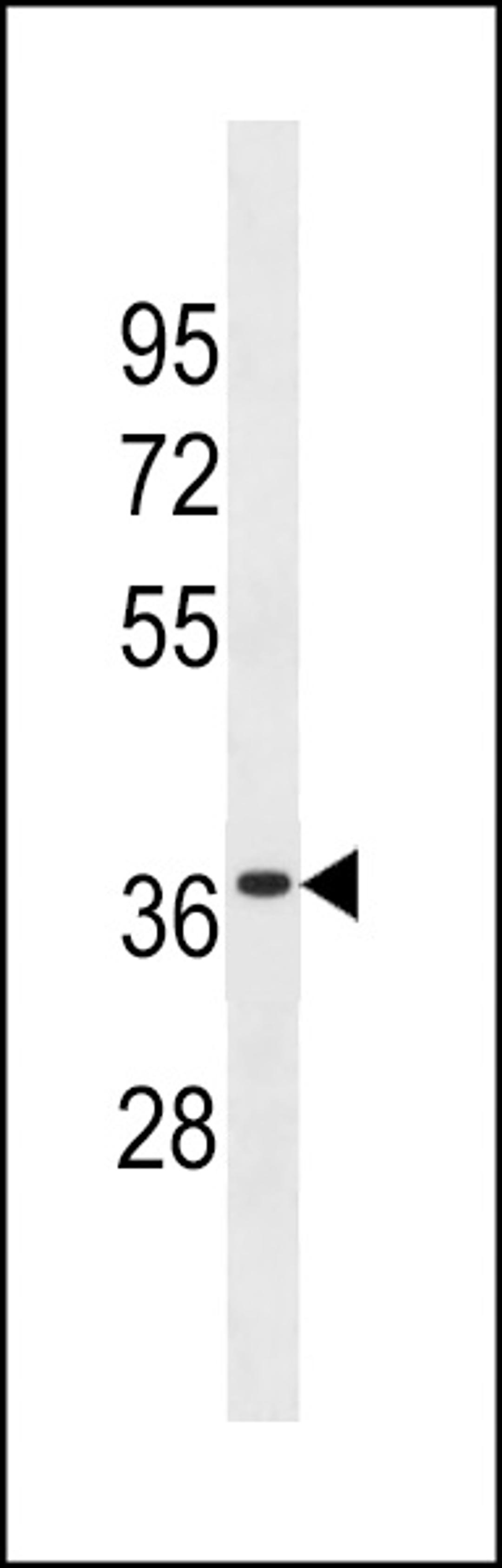 Western blot analysis in WiDr cell line lysates (35ug/lane).