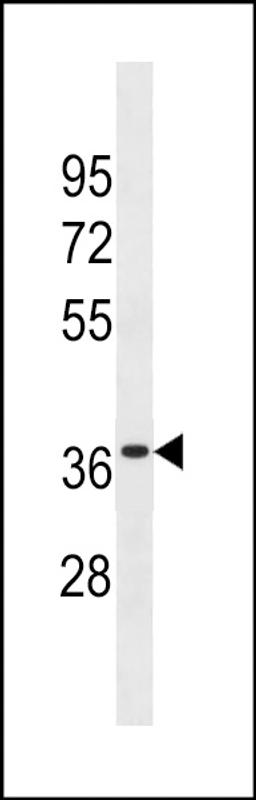 Western blot analysis in WiDr cell line lysates (35ug/lane).