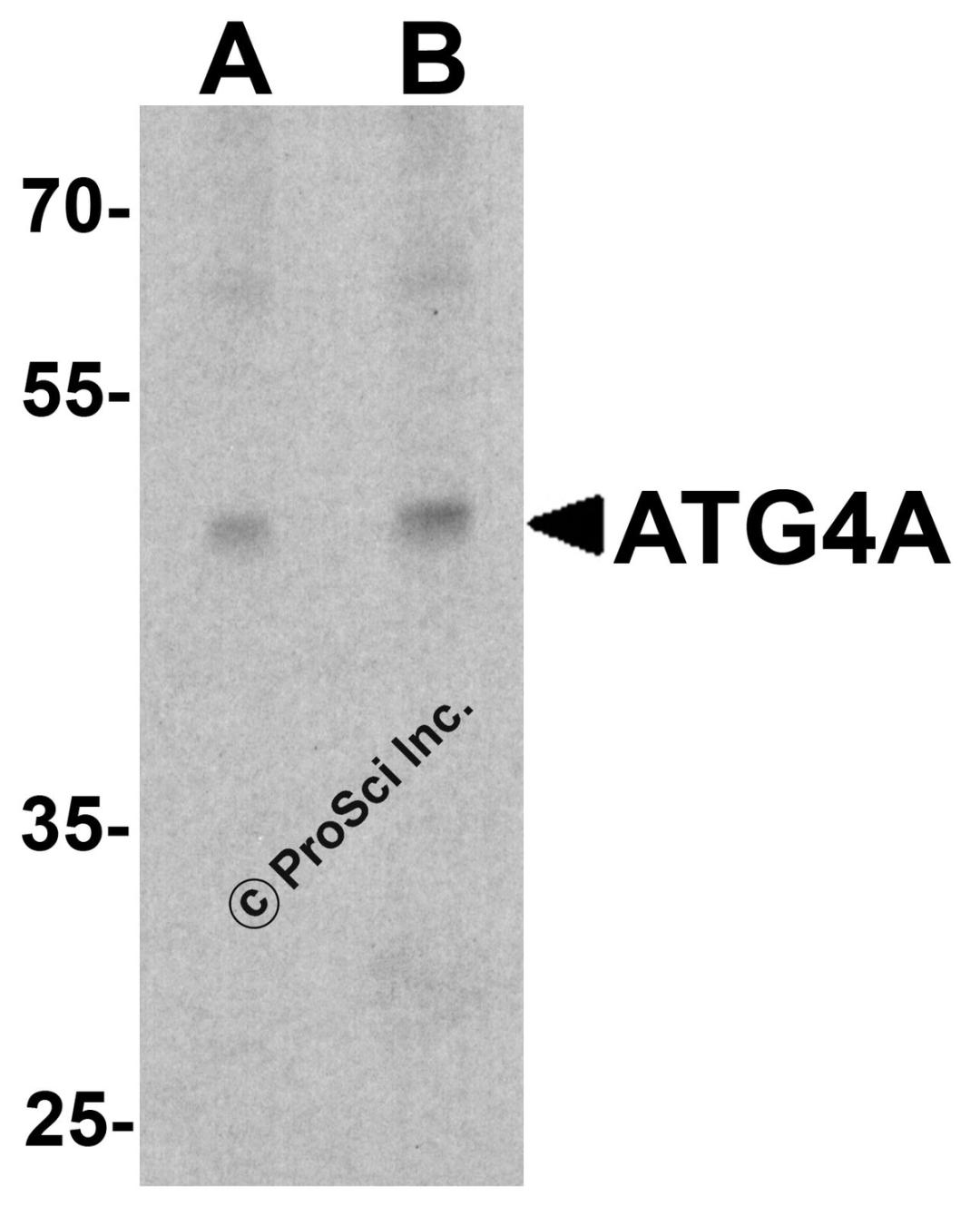 Western blot analysis of ATG4A in EL4 cell lysate with ATG4A antibody at (A) 1 and (B) 2 μg/ml.