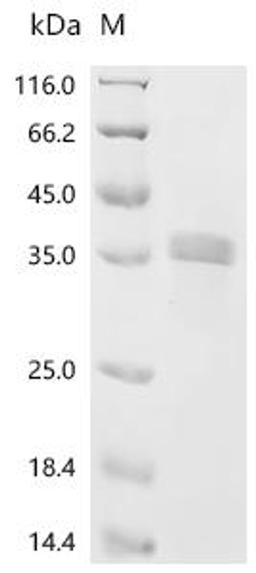 (Tris-Glycine gel) Discontinuous SDS-PAGE (reduced) with 5% enrichment gel and 15% separation gel.