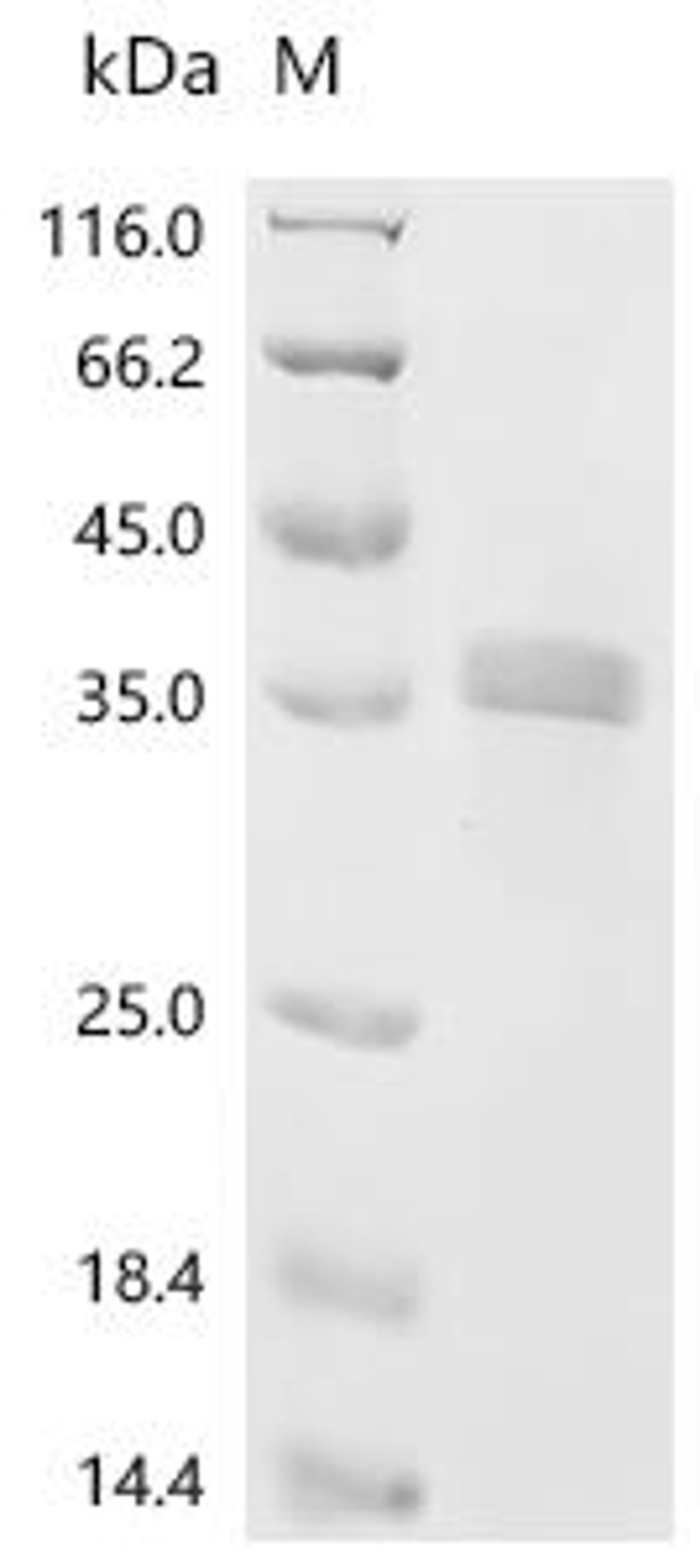 (Tris-Glycine gel) Discontinuous SDS-PAGE (reduced) with 5% enrichment gel and 15% separation gel.