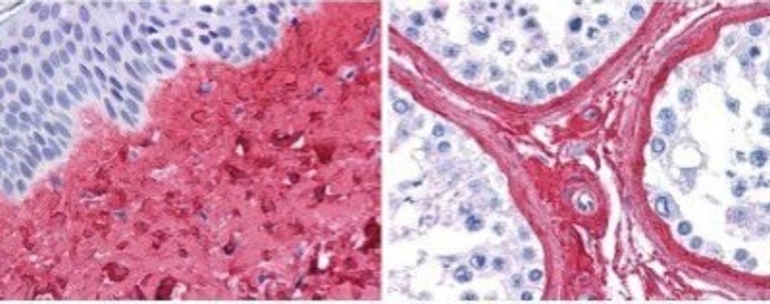 Immunohistochemistry-Paraffin: Collagen III alpha 1/COL3A1 Antibody [NB600-594] - Analysis using the Biotin conjugate of NB600-594. This antibody showed strong staining in FFPE sections of human skin(left, dermis) with moderate to strong red staining and testis (right) where strong staining was observed within connective tissue between seminiferous tubules. The antibody showed strong extracellular staining within connective tissues across many organs with minimal background staining. Slides were steamed in 0.01 M sodium citrate buffer, pH 6.0 at 99-100C - 20 minutes for antigen retrieval.