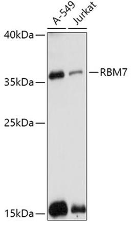 Western blot - RBM7 antibody (A17605)