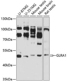 Western blot - GLRA1 antibody (A2958)