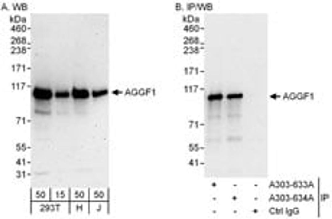 Detection of human AGGF1 by western blot and immunoprecipitation.