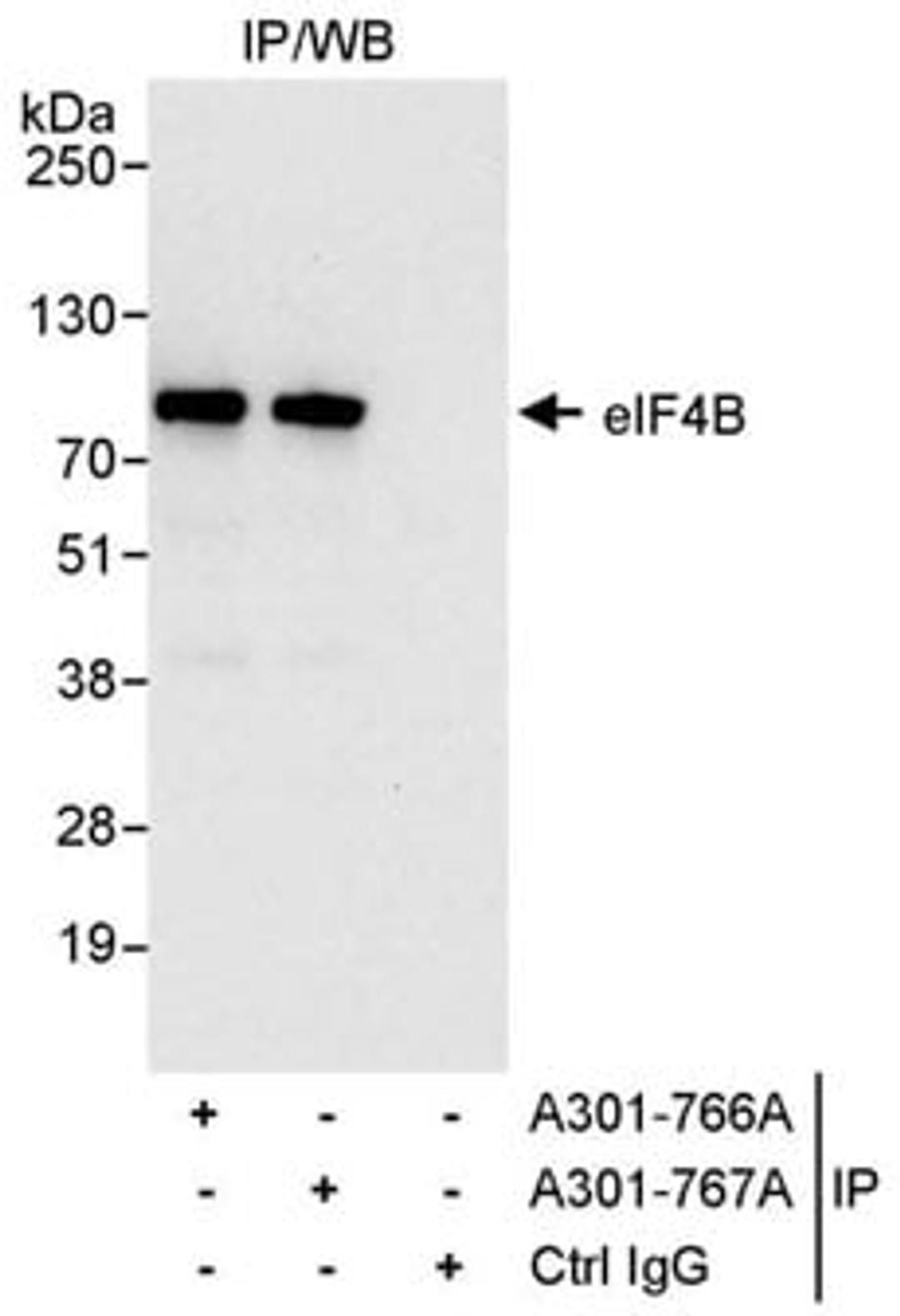 Detection of human eIF4B by western blot of immunoprecipitates.