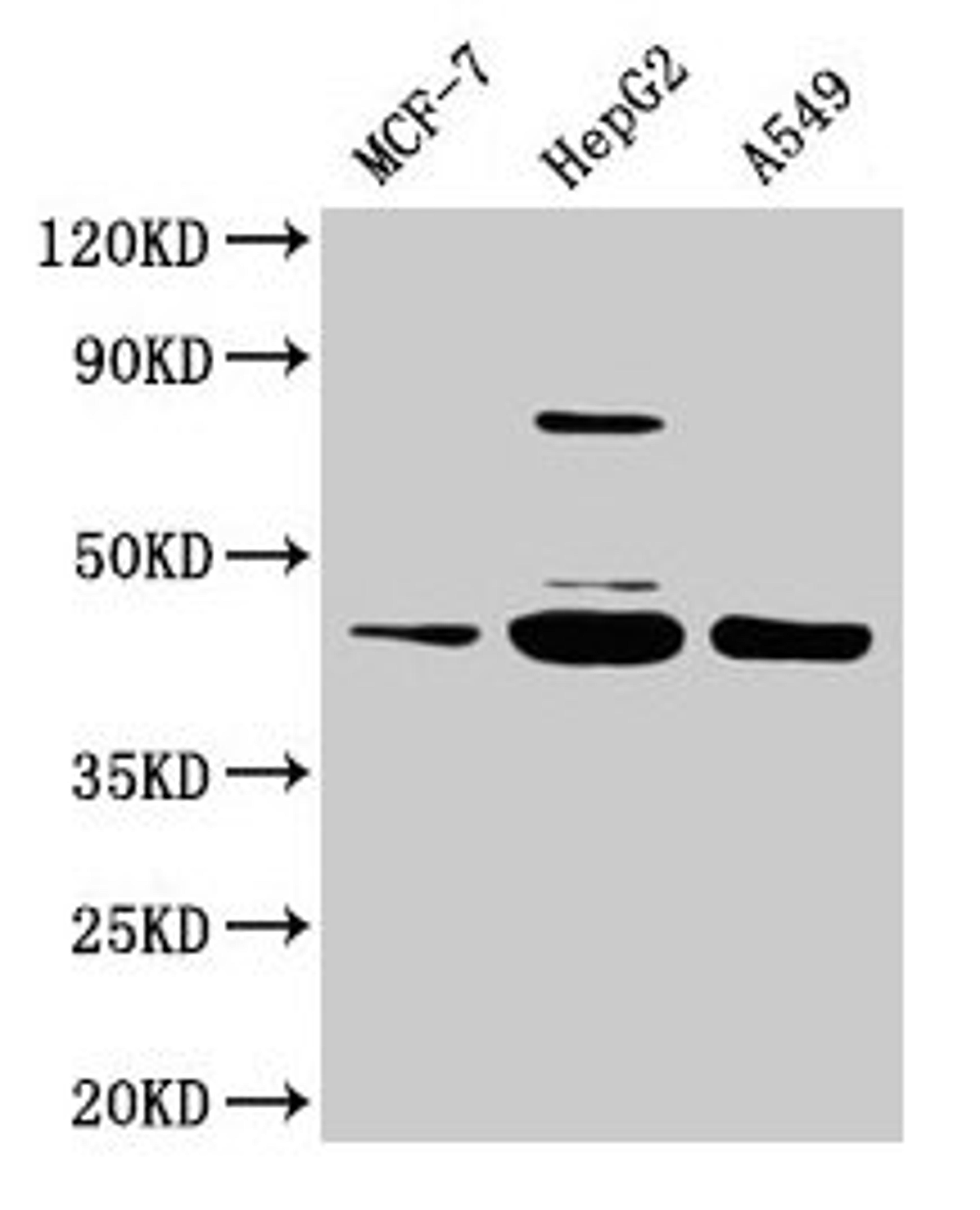 Western Blot. Positive WB detected in: MCF-7 whole cell lysate, HepG2 whole cell lysate, A549 whole cell lysate. All lanes: SERPINB1 antibody at 2µg/ml. Secondary. Goat polyclonal to rabbit IgG at 1/50000 dilution. Predicted band size: 43, 27 kDa. Observed band size: 43 kDa
