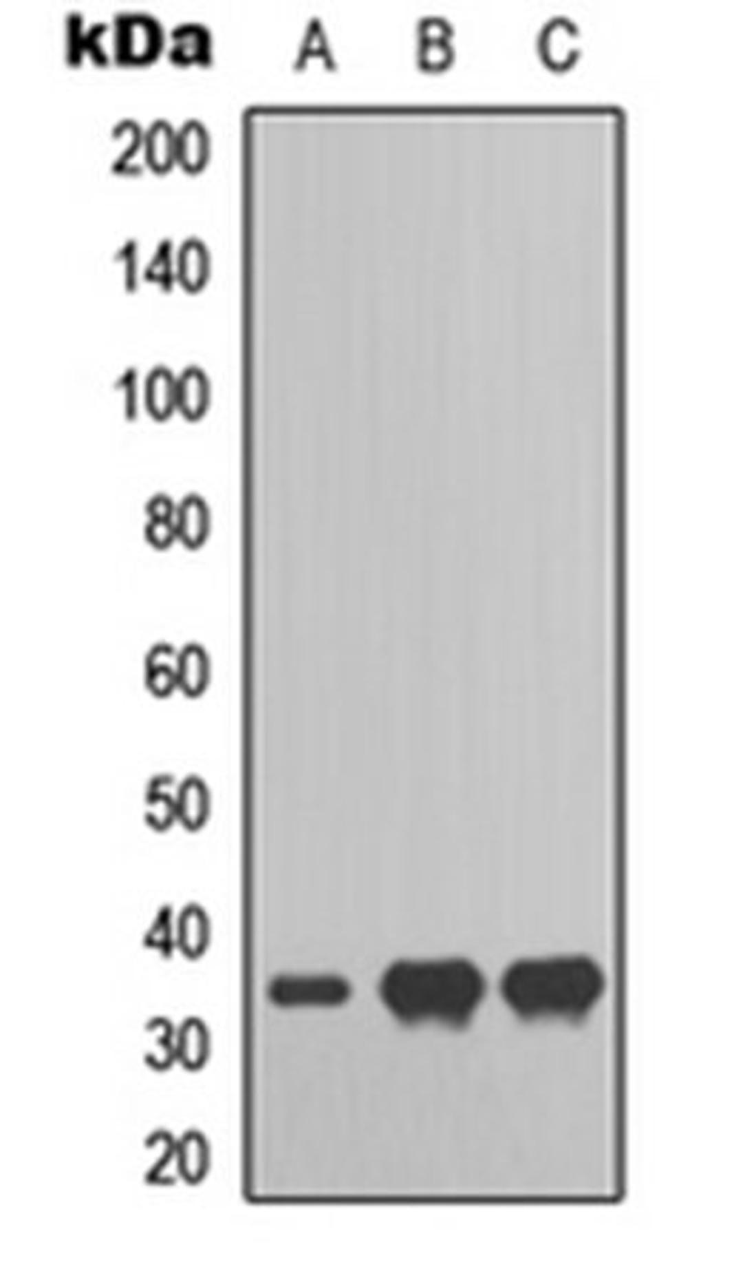 Western blot analysis of HepG2 (Lane 1), HEK293T (Lane 2), Hela (Lane 3) whole cell lysates using RAD51D antibody