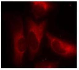 Immunocytochemistry/Immunofluorescence: 14-3-3 zeta [p Ser58] Antibody [NB100-81766] - Immunofluorescence staining of mehtanol-fixed HEla cells using 14-3-3 zeta (p Ser58) antibody.