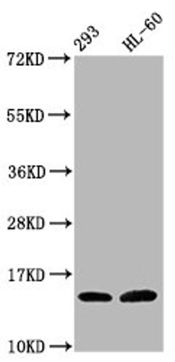 Western Blot. Positive WB detected in: 293 whole cell lysate, HL60 whole cell lysate (all treated with 30mM sodium butyrate for 4h). All lanes: HIST1H2BC antibody at 1.7µg/ml. Secondary. Goat polyclonal to rabbit IgG at 1/50000 dilution. Predicted band size: 14 kDa. Observed band size: 14 kDa