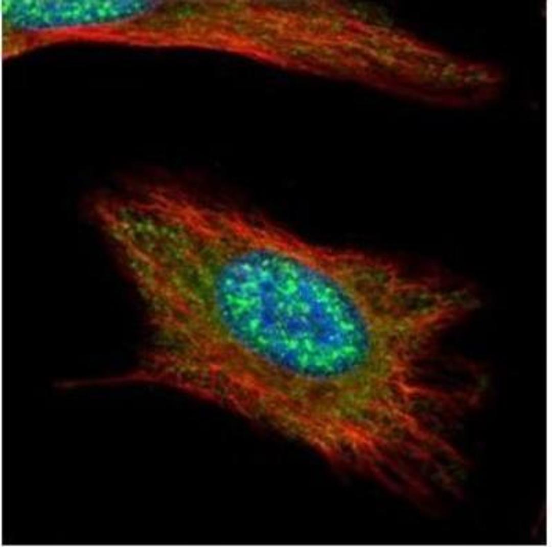 Immunocytochemistry/Immunofluorescence: Anillin Antibody [NBP1-31060] - Analysis of methanol-fixed HeLa, using Anillin antibody (Green) at 1:500 dilution. Alpha-tubulin filaments were labeled with an alpha Tubulin antibody (Red) at 1:2000.